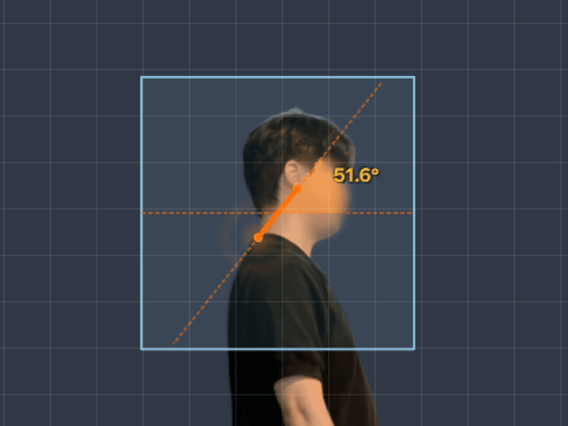 측면 실사 3D 위에 거북목 각도 측정선과 51.6°가 표시된 화면