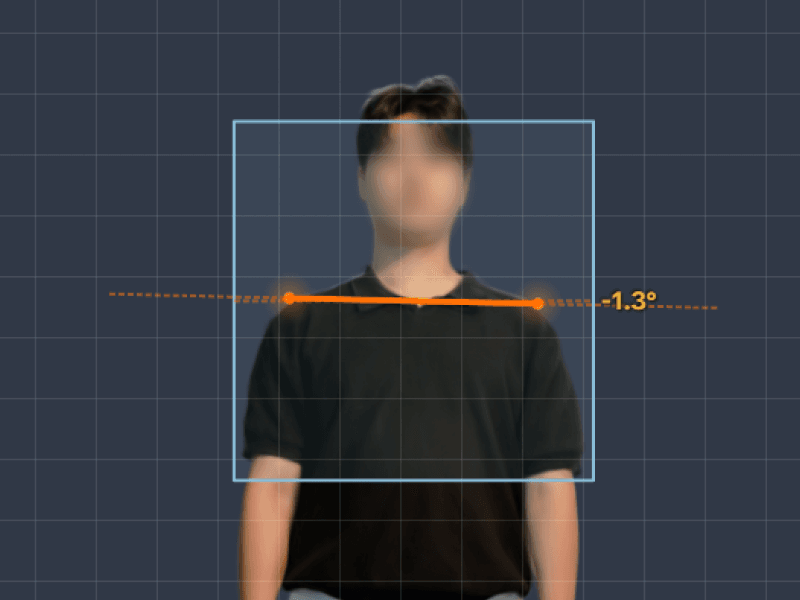 정면 실사 3D 위에 어깨 기울기 측정선과 -1.3°가 표시된 화면
