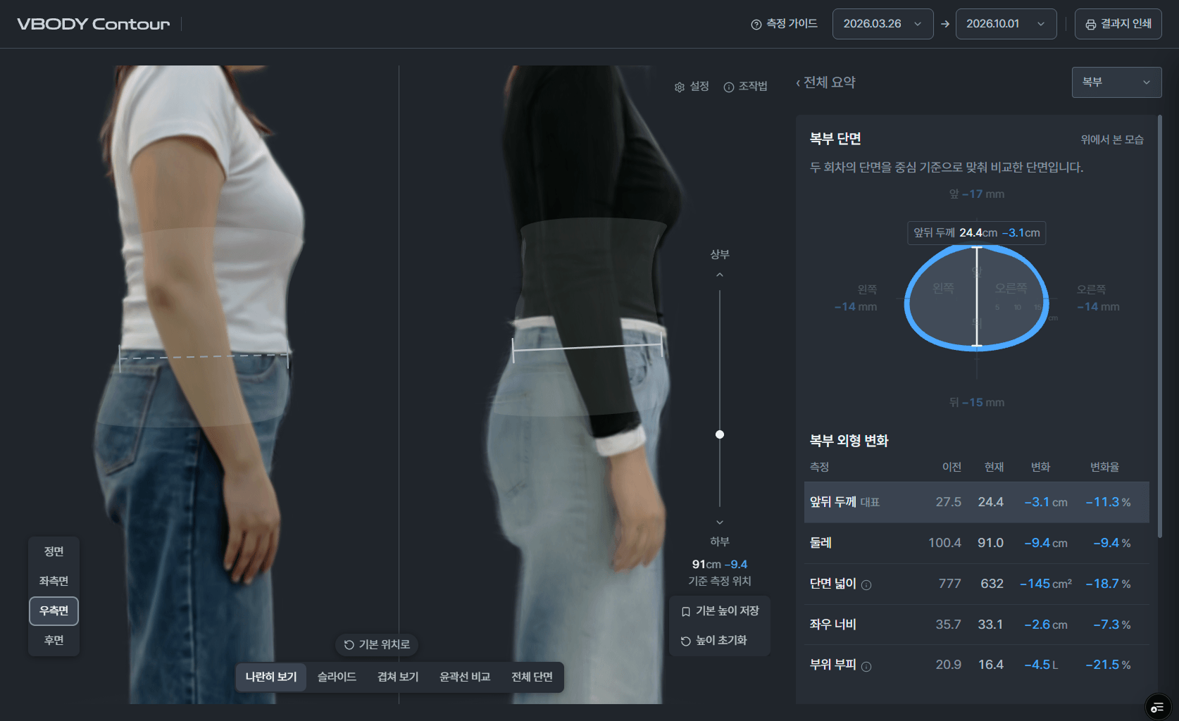 实际VBODY Contour画面 — 以右侧3D并排对比2026.03.26与2026.10.01的测量,右侧显示腹部截面,以及前后厚度、围度、截面积、左右宽度、部位体积的上次值、本次值、变化量和变化率