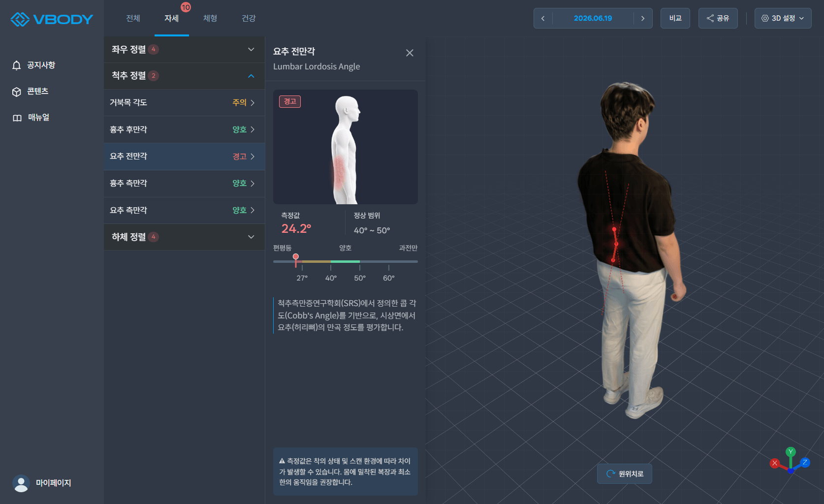 척추 정렬의 요추 전만각 항목을 선택해 측정값 24.2°, 정상 범위 40°~50°, 경고 단계가 표시되고, 실사 3D 위에 척추 측정선이 표시된 자세 분석 리포트 화면
